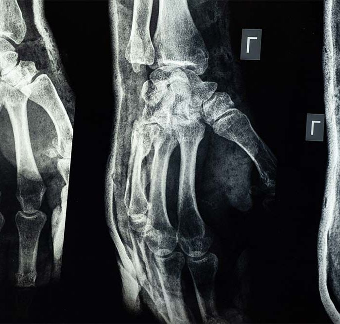 Lesioni di lieve entit&agrave;