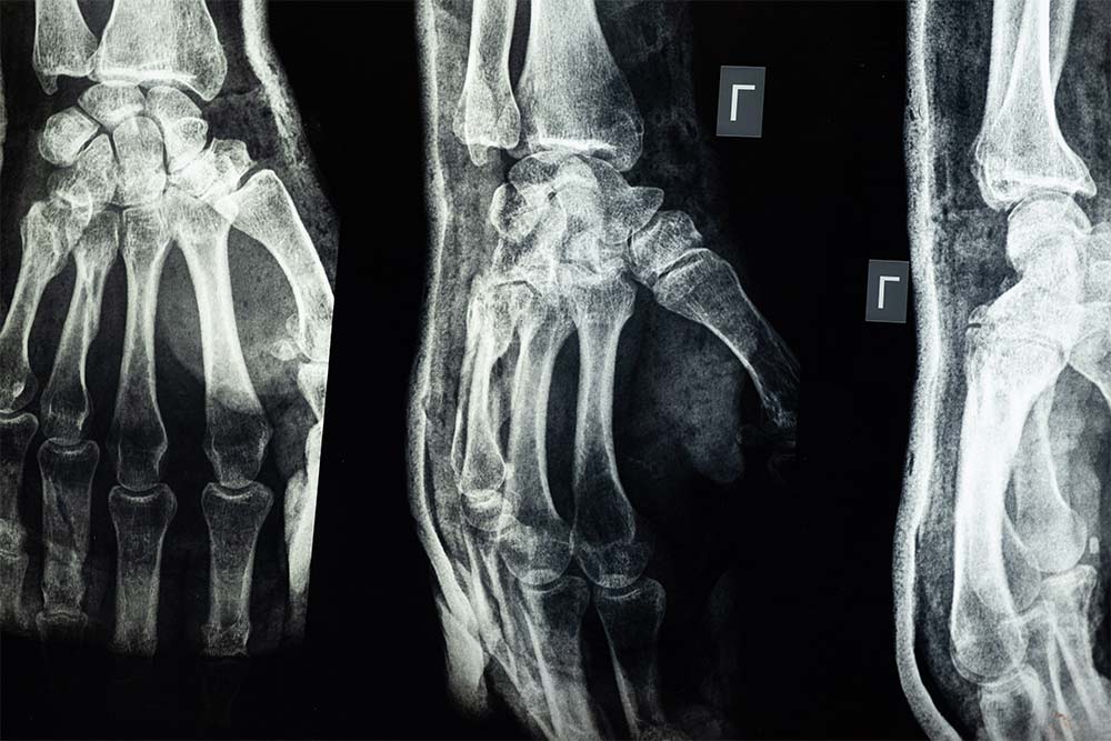 Lesioni di lieve entità